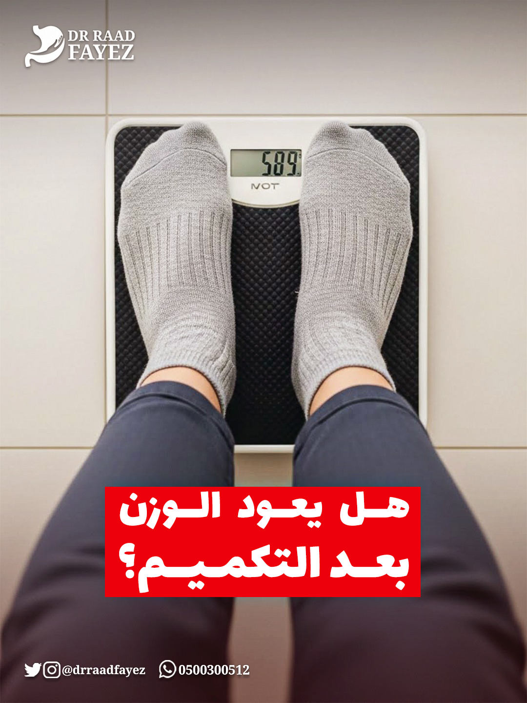 هل يعود الوزن بعد التكميم؟